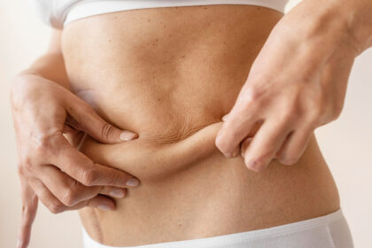 Tecnologia melhora retração da pele após lipoaspiração