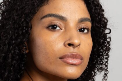 Mês de Conscientização da Acne incentiva cuidados especiais